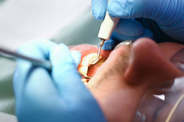 Best Pediatric Emergency Dentist in Pontoon Beach, IL